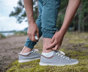 Insect Bites