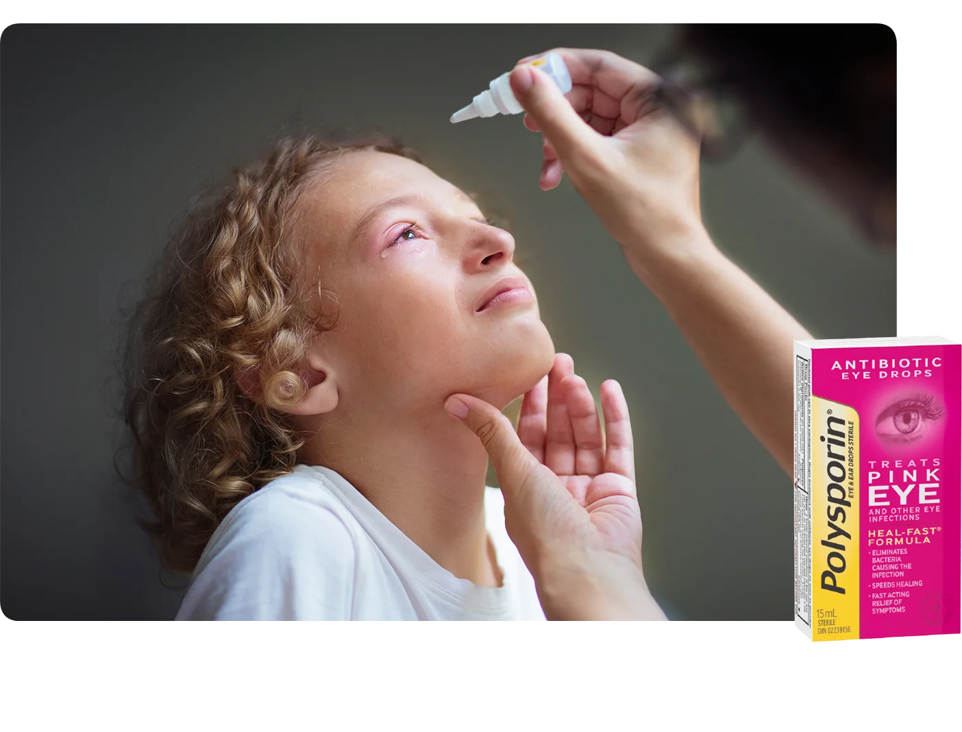 Symptoms of Bacterial Pink Eye